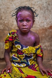 Africa;Benin;Chickenpox;Children;Girls;Kaleidos;Kaleidos-images;La-parole-Ã -limage;Pink;Tarek-Charara