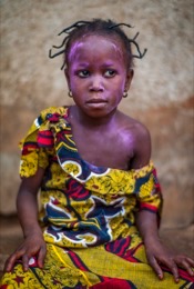 Africa;Benin;Chickenpox;Children;Girls;Kaleidos;Kaleidos-images;La-parole-Ã -limage;Pink;Tarek-Charara